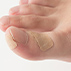 Foot Care Tape for ingrown nail
